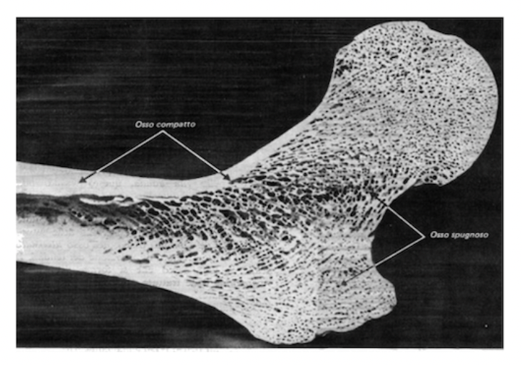osteoporosi3