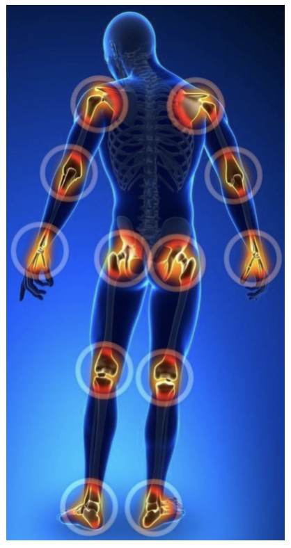 Come curare la magnetoterapia | Sanotech